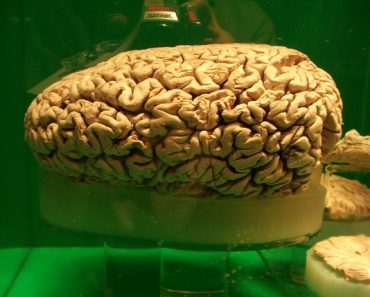 What animal has the largest brain