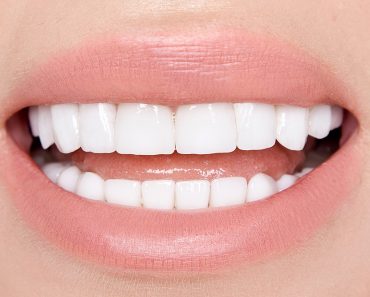 How do teeth whiteners work